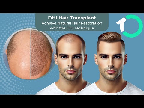 DHI Direct Hair Implantation (Choi Pen) - Surgical Procedure - One Clinic Patient Review Video