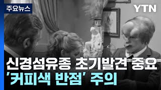 '연한 커피색 반점 주의'...신경섬유종증, 방치하면 '백약이 무효'