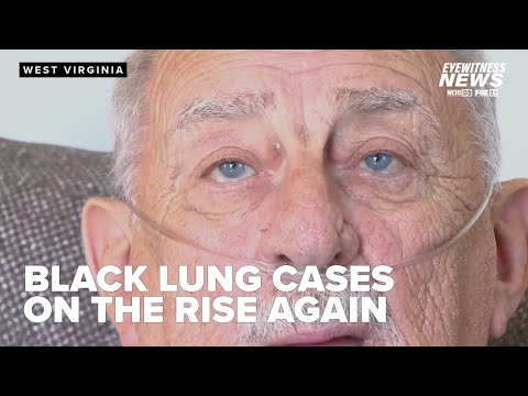 Black lung cases continue to rise among miners as preventative measures stall