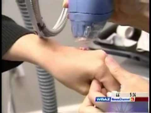 Fraxil Treatment on NBC