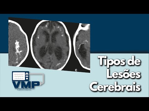 Tomografias de pacientes neurológicos