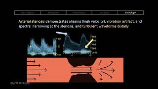 Vascular ultrasound made simple
