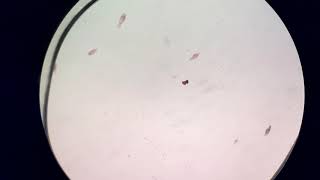 BIS2B Lab 3 Sampling Blepharisma