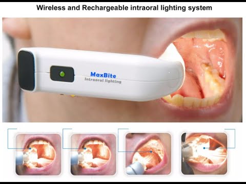 Intraoral lighting for dental clinics - A new must-have by dentalkart