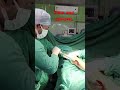 Tibia nail removal | Tibia bone fracture| Leg bone rod removal | Bone rod removal #bone #fracture
