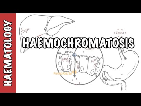 Hemochromatoza - fizjologia metabolizmu żelaza, przyczyny i patofizjologia
