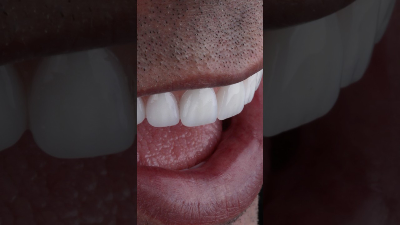 Danilo Monteiro Rezende Pereira-44