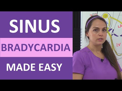 Sinus Bradycardia ECG/EKG Interpretation, Causes, Treatment, Nursing NCLEX Review Cardiac