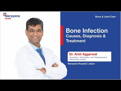 Understanding Bone Infection or Osteomyelitis: Causes, Symptoms, and Treatment