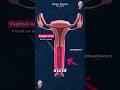 How Long Is The Vaginal Canal ‍ ️