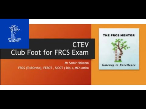 CTEV/Club Foot
