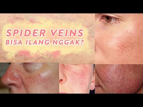 Slimming Belt nougat Pria memutuskan untuk menurunkan berat badan