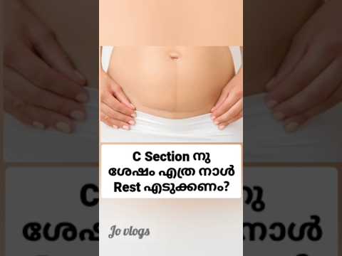 C section #youtubeshorts #csectionrecovery #shorts #malayalam #pregnancy #postpartum