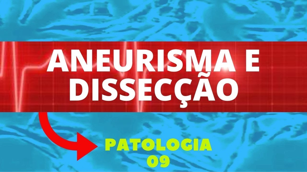 ANEURISMA E DISSECÇÃO DOS VASOS - PATOLOGIA - AULA 9
