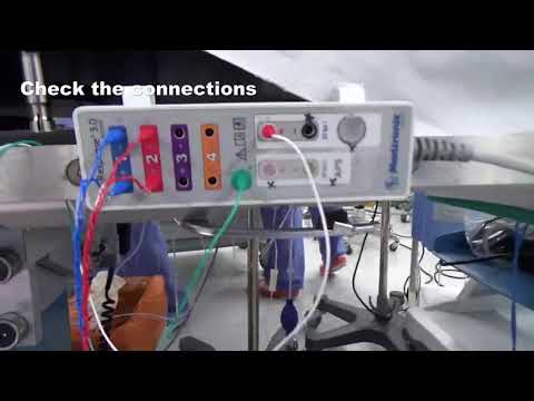 How to setup the intra-operative neuromonitoring