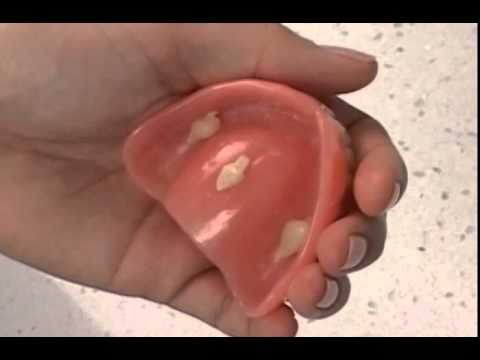 Quello che dice un posto di pigmentary su un dorso su Il pigmentary nota la ragione in un fegato