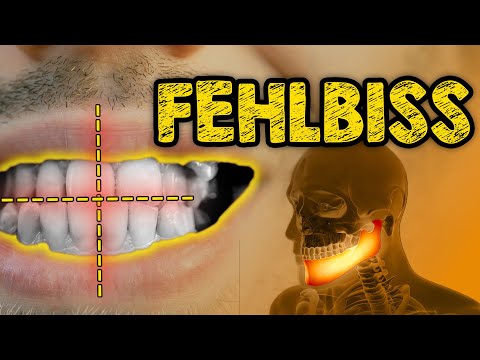 Overbite & Co? How to effectively treat jaw misalignments