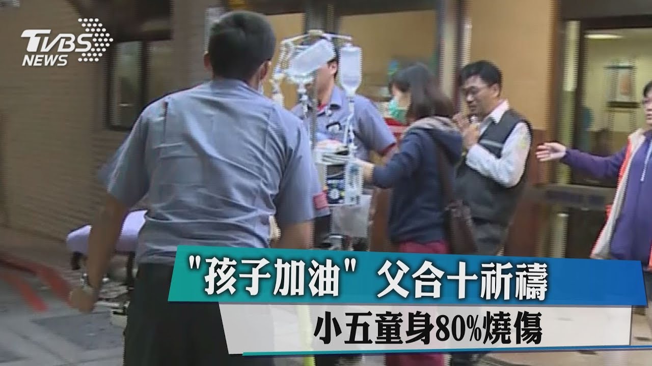 「孩子加油!」父合十祈禱 小五童身80%燒傷