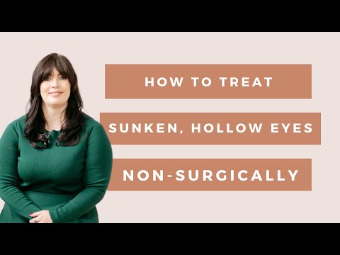 How to Treat Sunken and Hollow Eyes Non Surgically