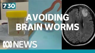 How worried should we be about brain worms and parasites? | 7.30