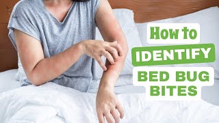 How to Identify Bed Bug Bites: Your Ultimate Guide to Detecting and Dealing with Them