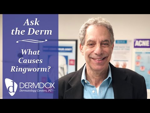 Ask the Derm - What causes ringworm - DermDox Dermatology Centers