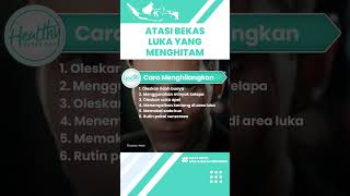 Obat Alami Atasi Bekas Luka yang Menghitam dengan Mudah: Oleskan Lidah Buaya & Minyak Kelapa