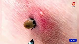 Alert in Cajeme due to rise in rickettsia cases