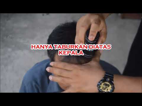 MASALAH RAMBUT BOTAK / RONTOK