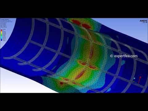 Modeling and Simulation of Stainless Steel Stent with Different Expansions - ANSYS Static Structural