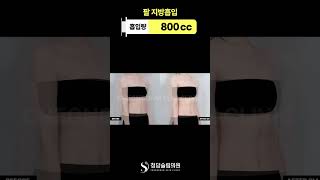 연예인처럼 여리한 팔라인 느낌 남 ✨