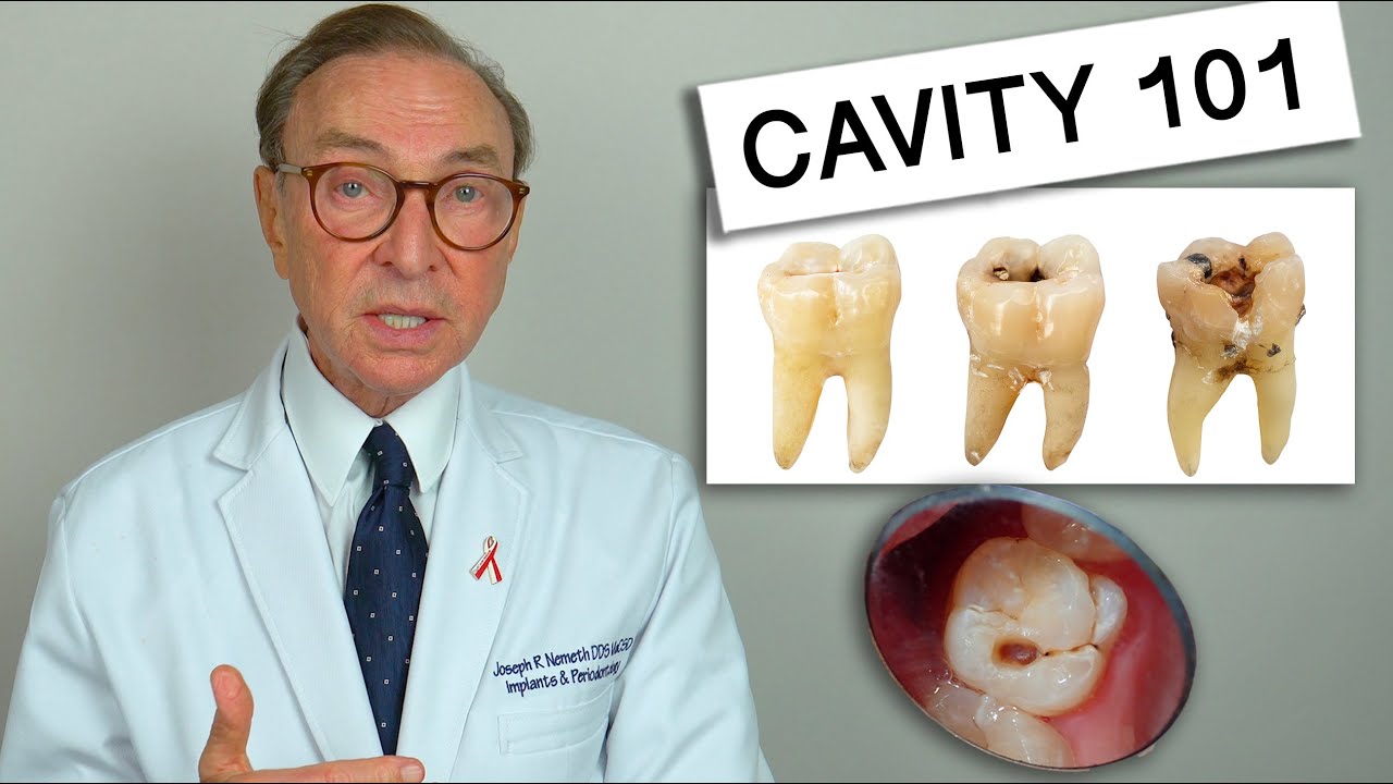 What Causes Tooth Decay? Cavity 101 | Causes | Treatment