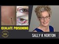 Oxalate Poisoning & Dumping: What It Looks Like, the Microbiome Myth & Why Zero Carb May Not Work