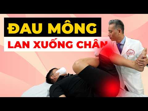Tại sao ngồi lâu lại đau mông lan xuống chân? ĐỪNG CHỦ QUAN!
