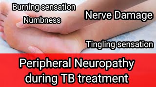 My experience| Nerve Damage during TB treatment| Peripheral Neuropathy|Colours of life. 