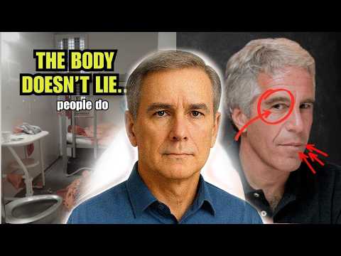 Learn the Reasons Behind Fibromyalgia and Sjogren's - You Won't Believe What Causes It!