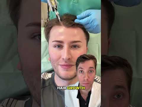 Considering PRP for Hair Loss?