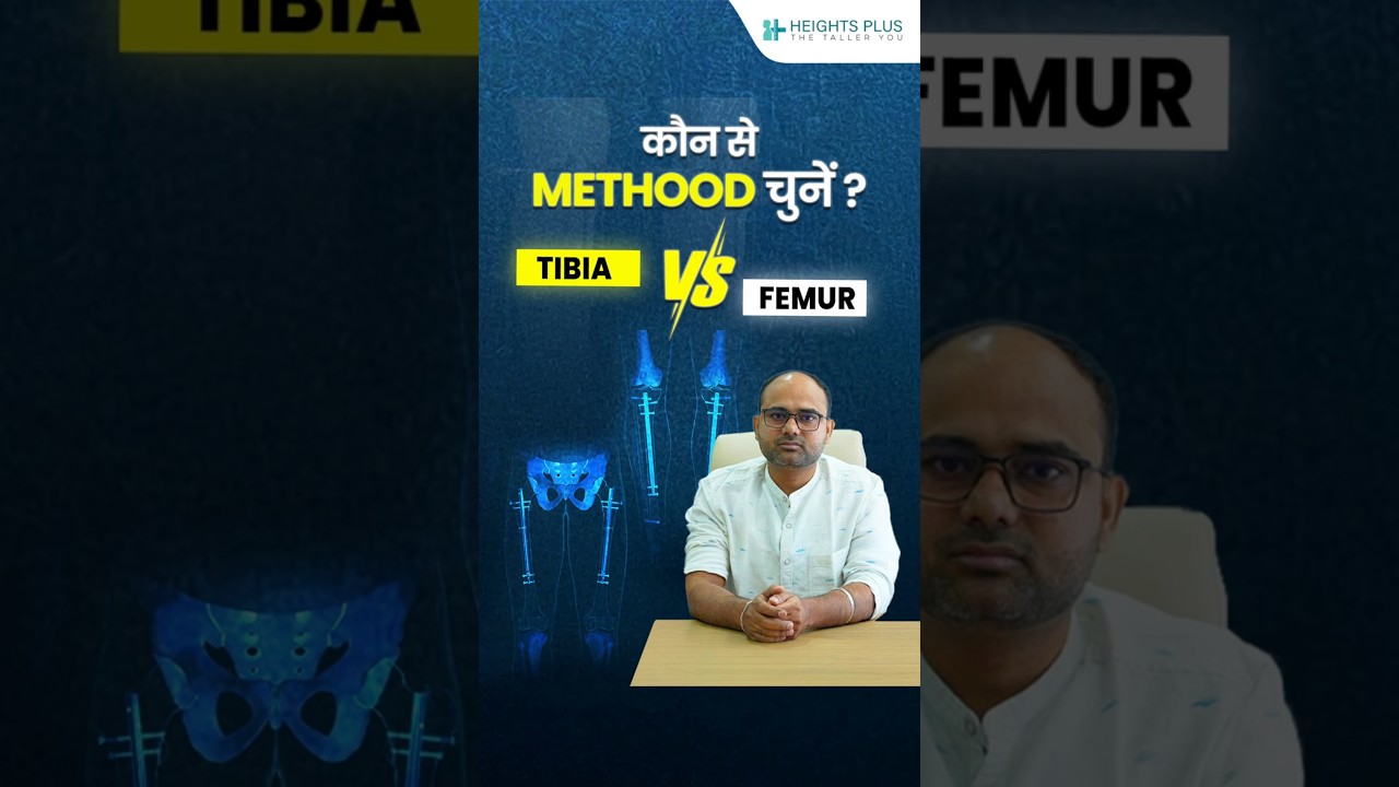 कौन से methods चुने Tibia And Femur?