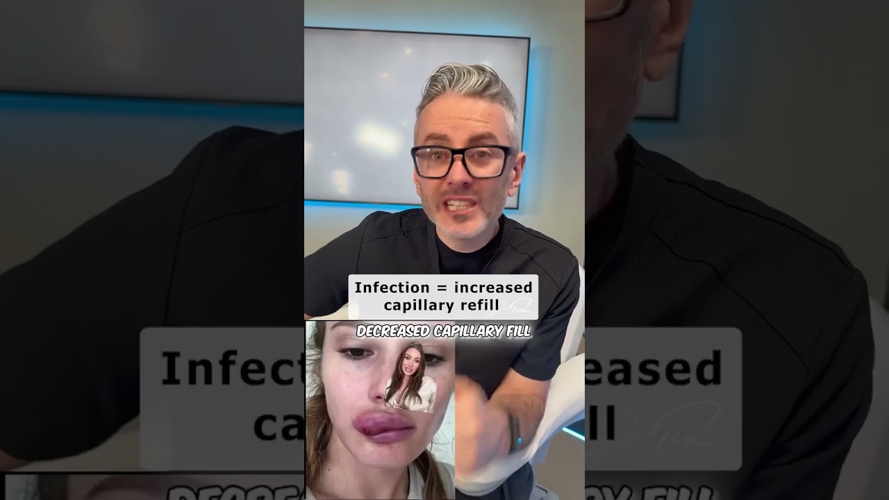 How to diagnose infection vs VO