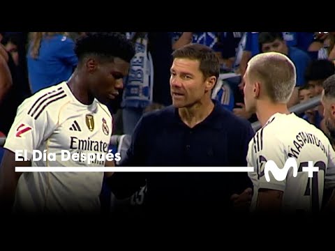 El Día Después (25/08/2025): Los mandamientos de Xabi Alonso.