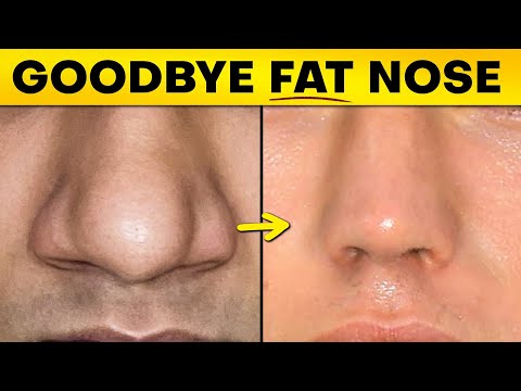 How To Fix Wide Nose?