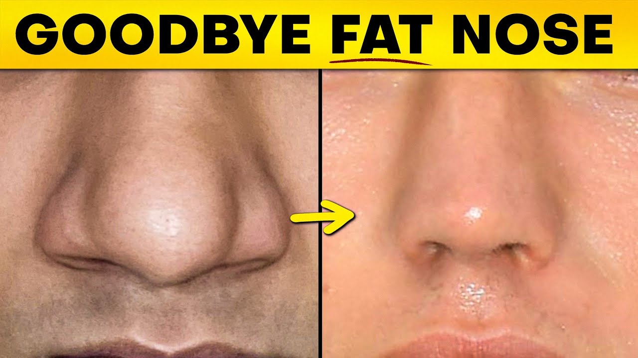 How To Fix Wide Nose?