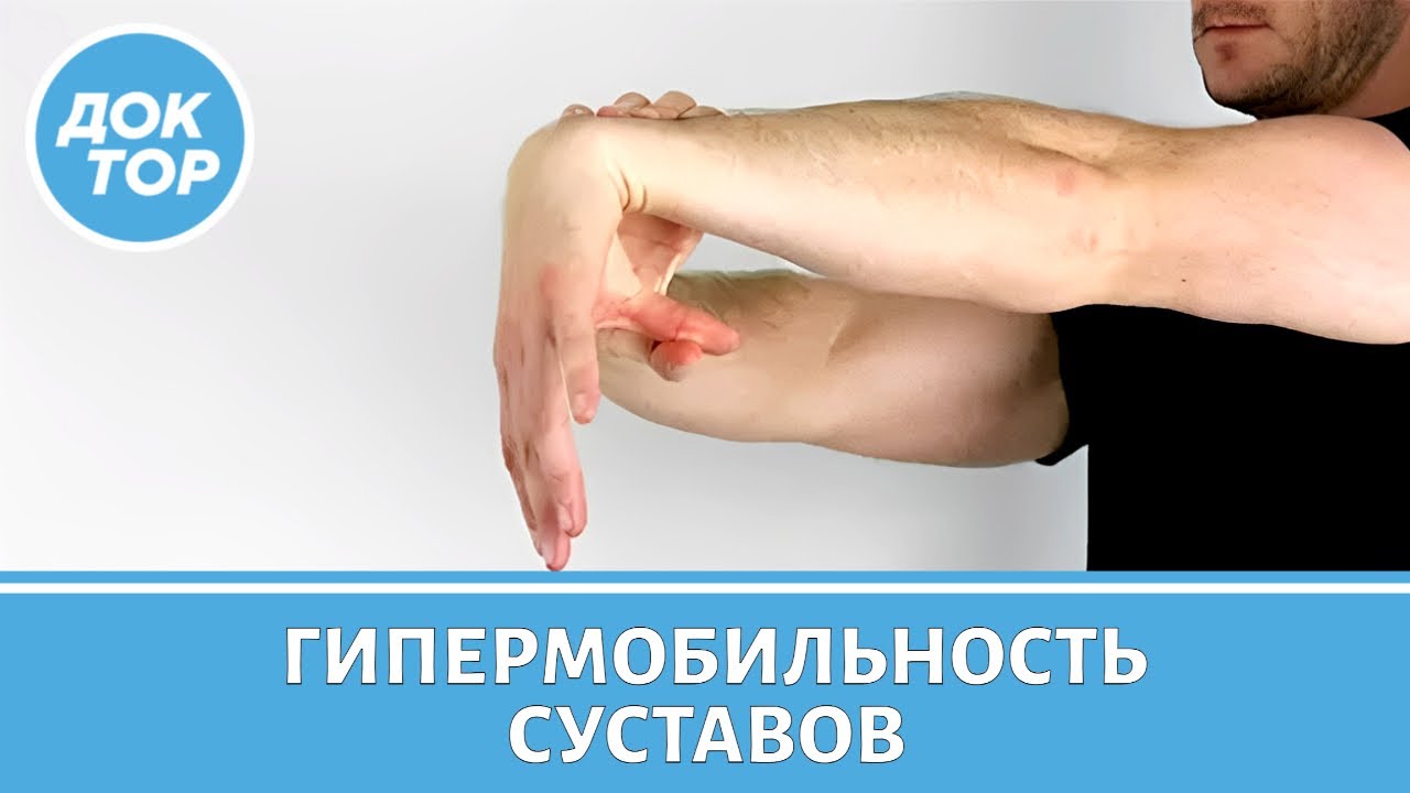 Что такое гипермобильность суставов / Когда это состояние опасно