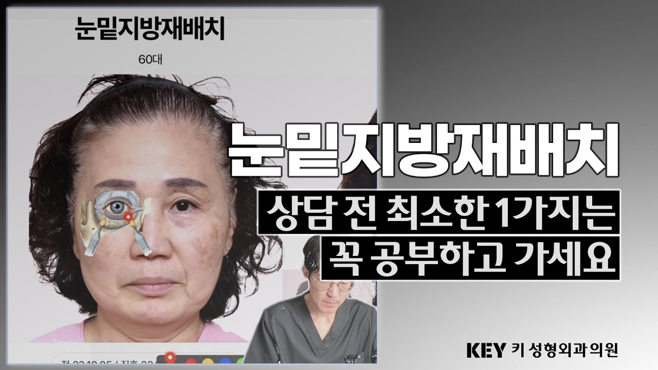 Ep3. 눈밑지방재배치 공부하기