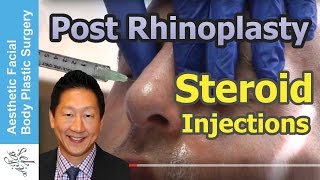 Dr. Philip Young