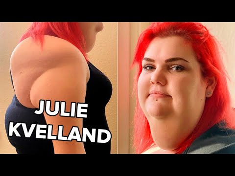 Julie Kvelland har lært at acceptere sig selv