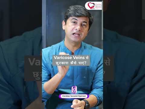 Varicose Veins: Symptoms, Causes & Treatment