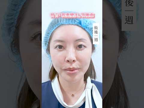 北秀醫美短影音 5