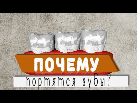 Почему портятся зубы? Why do teeth get spoiled?
