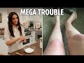 Meghan Markle Fan Says Homemade Bath Salt Recipe Left Her With BURNS Threatens 10m Lawsuit